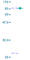 ab162702 on a 12.5% SDS-PAGE stained with Coomassie Blue.