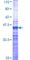 ab162703 on a 12.5% SDS-PAGE stained with Coomassie Blue.