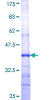 ab163043 on a 12.5% SDS-PAGE stained with Coomassie Blue.