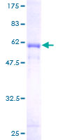 ab158442 on a 12.5% SDS-PAGE stained with Coomassie Blue.