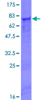 ab161182 on a 12.5% SDS-PAGE stained with Coomassie Blue.