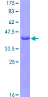 ab161183 on a 12.5% SDS-PAGE stained with Coomassie Blue.