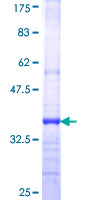 ab158444 on a 12.5% SDS-PAGE stained with Coomassie Blue.