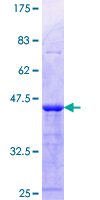 ab162223 on a 12.5% SDS-PAGE stained with Coomassie Blue.