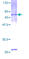 ab160365 on a 12.5% SDS-PAGE stained with Coomassie Blue.