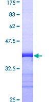 ab158441 on a 12.5% SDS-PAGE stained with Coomassie Blue.