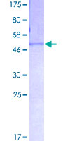 ab158432 on a 12.5% SDS-PAGE stained with Coomassie Blue.