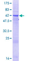 ab158426 on a 12.5% SDS-PAGE stained with Coomassie Blue.