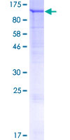 ab160703 on a 12.5% SDS-PAGE stained with Coomassie Blue.