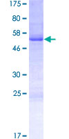 ab166309 on a 12.5% SDS-PAGE stained with Coomassie Blue.