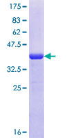 ab166310 on a 12.5% SDS-PAGE stained with Coomassie Blue.