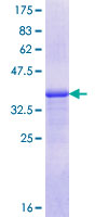 ab162976 on a 12.5% SDS-PAGE stained with Coomassie Blue.