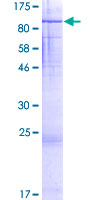 ab163765 on a 12.5% SDS-PAGE stained with Coomassie Blue.