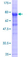 ab164349 on a 12.5% SDS-PAGE stained with Coomassie Blue.