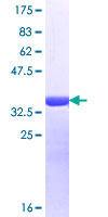 ab160628 on a 12.5% SDS-PAGE stained with Coomassie Blue.