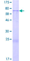 ab161773 on a 12.5% SDS-PAGE stained with Coomassie Blue.