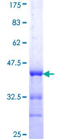 ab163738 on a 12.5% SDS-PAGE stained with Coomassie Blue.