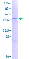ab162501 on a 12.5% SDS-PAGE stained with Coomassie Blue.