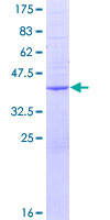 ab166567 on a 12.5% SDS-PAGE stained with Coomassie Blue.