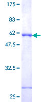 ab162626 on a 12.5% SDS-PAGE stained with Coomassie Blue.