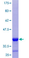 ab162627 on a 12.5% SDS-PAGE stained with Coomassie Blue.