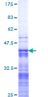 ab160043 on a 12.5% SDS-PAGE stained with Coomassie Blue.
