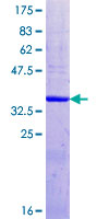 ab153505 on a 12.5% SDS-PAGE stained with Coomassie Blue.