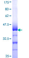 ab158335 on a 12.5% SDS-PAGE stained with Coomassie Blue.