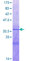ab158457 on a 12.5% SDS-PAGE stained with Coomassie Blue.
