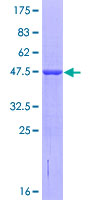 ab166271 on a 12.5% SDS-PAGE stained with Coomassie Blue.