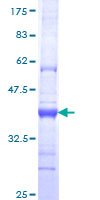 ab166272 on a 12.5% SDS-PAGE stained with Coomassie Blue.