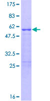 ab166415 on a 12.5% SDS-PAGE stained with Coomassie Blue.