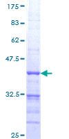 ab166416 on a 12.5% SDS-PAGE stained with Coomassie Blue.
