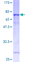ab153058 on a 12.5% SDS-PAGE stained with Coomassie Blue.