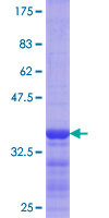 ab153059 on a 12.5% SDS-PAGE stained with Coomassie Blue.