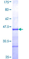 ab162194 on a 12.5% SDS-PAGE stained with Coomassie Blue.