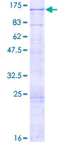 ab164540 on a 12.5% SDS-PAGE stained with Coomassie Blue.