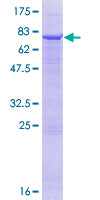 ab158456 on a 12.5% SDS-PAGE stained with Coomassie Blue.