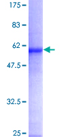 ab158458 on a 12.5% SDS-PAGE stained with Coomassie Blue.