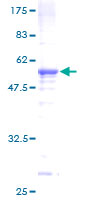 ab165702 on a 12.5% SDS-PAGE stained with Coomassie Blue.