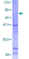ab158460 on a 12.5% SDS-PAGE stained with Coomassie Blue.