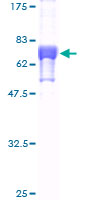 ab158461 on a 12.5% SDS-PAGE stained with Coomassie Blue.