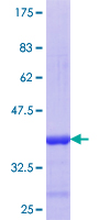 ab158462 on a 12.5% SDS-PAGE stained with Coomassie Blue.
