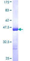 ab165738 on a 12.5% SDS-PAGE stained with Coomassie Blue.