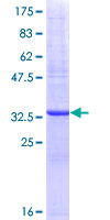 ab158464 on a 12.5% SDS-PAGE stained with Coomassie Blue.