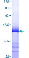 ab161679 on a 12.5% SDS-PAGE stained with Coomassie Blue.