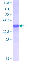 ab165862 on a 12.5% SDS-PAGE stained with Coomassie Blue.