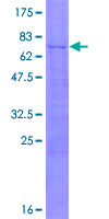 ab166227 on a 12.5% SDS-PAGE stained with Coomassie Blue.