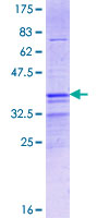 ab166341 on a 12.5% SDS-PAGE stained with Coomassie Blue.