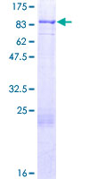 ab153411 on a 12.5% SDS-PAGE stained with Coomassie Blue.